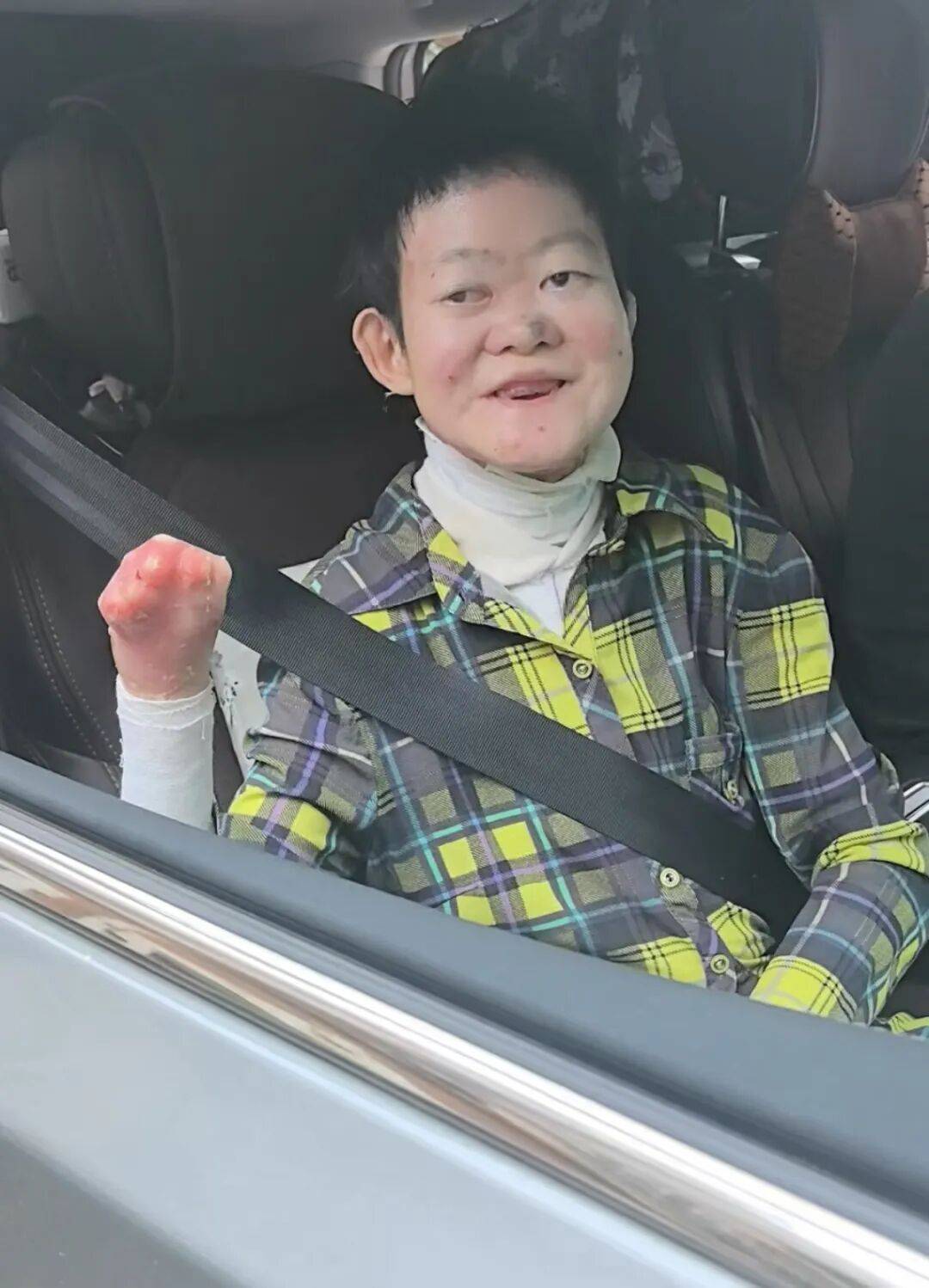 醫(yī)生斷言“活不過2歲”的鄭州罕見病女孩，24歲“帶傷出征”，開啟西藏之行:機械制造
